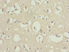 Immunohistochemistry of paraffin-embedded human brain tissue using CSB-PA016334ESR2HU at dilution of 1:100