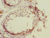 Immunohistochemistry of paraffin-embedded human testis tissue using CSB-PA875716ESR2HU at dilution of 1:100