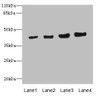 Western blot<br />
 All lanes: PPM1A antibody at 6.88µg/ml<br />
 Lane 1: HepG2 whole cell lysate<br />
 Lane 2: SH-SY5Y whole cell lysate<br />
 Lane 3: Mouse liver tissue<br />
 Lane 4: Mouse brain tissue<br />
 Secondary<br />
 Goat polyclonal to rabbit IgG at 1/10000 dilution<br />
 Predicted band size: 43, 36, 52 kDa<br />
 Observed band size: 43 kDa<br />