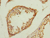Immunohistochemistry of paraffin-embedded human testis tissue using CSB-PA023655ESR2HU at dilution of 1:100