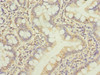 Immunohistochemistry of paraffin-embedded human small intestine tissue using CSB-PA719420DSR2HU at dilution of 1:100