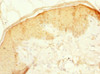 Immunohistochemistry of paraffin-embedded human skin tissue using CSB-PA896752ESR1HU at dilution of 1:100