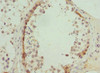 Immunohistochemistry of paraffin-embedded human testis tissue using CSB-PA859942ESR1HU at dilution of 1:100