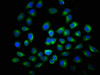 Immunofluorescence staining of A549 cells with CSB-PA892446DSR1HU at 1:116, counter-stained with DAPI. The cells were fixed in 4% formaldehyde, permeabilized using 0.2% Triton X-100 and blocked in 10% normal Goat Serum. The cells were then incubated with the antibody overnight at 4°C. The secondary antibody was Alexa Fluor 488-congugated AffiniPure Goat Anti-Rabbit IgG (H+L) .