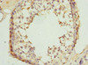 Immunohistochemistry of paraffin-embedded human testis tissue using CSB-PA770347ESR1HU at dilution of 1:100