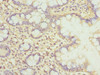 Immunohistochemistry of paraffin-embedded human small intestine tissue using CSB-PA770347ESR1HU at dilution of 1:100