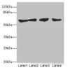 Western blot<br />
 All lanes: CLK1antibody at 3.07µg/ml<br />
 Lane 1: HepG2 whole cell lysate<br />
 Lane 2: Jurkat whole cell lysate<br />
 Lane 3: U251 whole cell lysate<br />
 Lane 4: A549 whole cell lysate<br />
 Secondary<br />
 Goat polyclonal to rabbit IgG at 1/10000 dilution<br />
 Predicted band size: 58, 17, 62 kDa<br />
 Observed band size: 58 kDa<br />