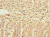 Immunohistochemistry of paraffin-embedded human adrenal gland tissue using CSB-PA007535ESR1HU at dilution of 1:100