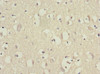 Immunohistochemistry of paraffin-embedded human brain tissue using CSB-PA007535ESR2HU at dilution of 1:100