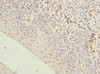 Immunohistochemistry of paraffin-embedded human tonsil tissue using CSB-PA010418ESR1HU at dilution of 1:100