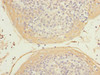 Immunohistochemistry of paraffin-embedded human tonsil tissue using CSB-PA010418ESR2HU at dilution of 1:100