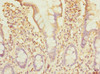 Immunohistochemistry of paraffin-embedded human small intestine tissue using CSB-PA022903DSR1HU at dilution of 1:100