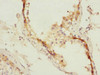 Immunohistochemistry of paraffin-embedded human testis tissue using CSB-PA013819ESR2HU at dilution of 1:100