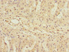 Immunohistochemistry of paraffin-embedded human adrenal gland tissue using CSB-PA890768ESR1HU at dilution of 1:100