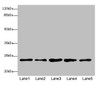Western blot<br />
 All lanes: RAB9A antibody at 7.66µg/ml<br />
 Lane 1: Jurkat whole cell lysate<br />
 Lane 2: K562 whole cell lysate<br />
 Lane 3: HepG2 whole cell lysate<br />
 Lane 4: 293T whole cell lysate<br />
 Lane 5: Hela whole cell lysate<br />
 Secondary<br />
 Goat polyclonal to rabbit IgG at 1/10000 dilution<br />
 Predicted band size: 23 kDa<br />
 Observed band size: 23 kDa<br />