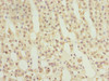 Immunohistochemistry of paraffin-embedded human adrenal gland tissue using CSB-PA019224DSR1HU at dilution of 1:100