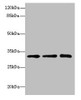 Western blot<br />
 All lanes: RRAS2 antibody at 4.55µg/ml<br />
 Lane 1: Mouse kidney tissue<br />
 Lane 2: Mouse liver tissue<br />
 Lane 3: Jurkat whole cell lysate<br />
 Secondary<br />
 Goat polyclonal to rabbit IgG at 1/10000 dilution<br />
 Predicted band size: 33, 29 kDa<br />
 Observed band size: 33 kDa<br />
