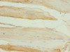 Immunohistochemistry of paraffin-embedded human skeletal muscle tissue using CSB-PA835688ESR1HU at dilution of 1:100