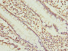 Immunohistochemistry of paraffin-embedded human small intestine tissue using CSB-PA835688ESR1HU at dilution of 1:100