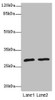 Western blot<br />
 All lanes: APIPantibody at 1.85µg/ml<br />
 Lane 1: Mouse heart tissue<br />
 Lane 2: Mouse kidney tissue<br />
 Secondary<br />
 Goat polyclonal to rabbit IgG at 1/10000 dilution<br />
 Predicted band size: 28, 23 kDa<br />
 Observed band size: 28 kDa<br />