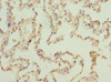 Immunohistochemistry of paraffin-embedded human lung tissue using CSB-PA839788ESR1HU at dilution of 1:100