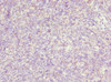 Immunohistochemistry of paraffin-embedded human thymus tissue using CSB-PA884624DSR2HU at dilution of 1:100