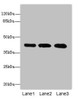 Western blot<br />
 All lanes: RRAGC antibody at 1.14µg/ml<br />
 Lane 1: Hela whole cell lysate<br />
 Lane 2: MCF-7 whole cell lysate<br />
 Lane 3: A549 whole cell lysate<br />
 Secondary<br />
 Goat polyclonal to rabbit IgG at 1/10000 dilution<br />
 Predicted band size: 44 kDa<br />
 Observed band size: 44 kDa<br />