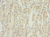 Immunohistochemistry of paraffin-embedded human adrenal gland tissue using CSB-PA867190ESR1HU at dilution of 1:100
