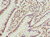 Immunohistochemistry of paraffin-embedded human small intestine tissue using CSB-PA867190ESR1HU at dilution of 1:100