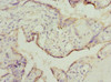Immunohistochemistry of paraffin-embedded human placenta tissue using CSB-PA839412ESR1HU at dilution of 1:100 Immunohistochemistry of paraffin-embedded human placenta tissue using CSB-PA839412ESR1HU at dilution of 1:100
