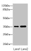 Western blot<br />
 All lanes: TOB2 antibody at 1.89µg/ml<br />
 Lane 1: Mouse skeletal muscle tissue<br />
 Lane 2: Mouse heart tissue<br />
 Secondary<br />
 Goat polyclonal to rabbit IgG at 1/10000 dilution<br />
 Predicted band size: 37, 28 kDa<br />
 Observed band size: 37 kDa<br />