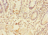 Immunohistochemistry of paraffin-embedded human small intestine tissue using CSB-PA024443ESR1HU at dilution of 1:100