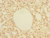 Immunohistochemistry of paraffin-embedded human adrenal gland tissue using CSB-PA024443ESR1HU at dilution of 1:100