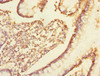 Immunohistochemistry of paraffin-embedded human small intestine tissue using CSB-PA024443ESR2HU at dilution of 1:100