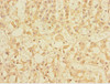 Immunohistochemistry of paraffin-embedded human adrenal gland tissue using CSB-PA024443ESR2HU at dilution of 1:100