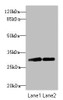 Western blot<br />
 All lanes: TRIM69 antibody at 2.24µg/ml<br />
 Lane 1: Mouse kidney tissue<br />
 Lane 2: Mouse brain tissue<br />
 Secondary<br />
 Goat polyclonal to rabbit IgG at 1/10000 dilution<br />
 Predicted band size: 58, 40, 35, 33 kDa<br />
 Observed band size: 58, 32 kDa<br />