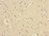 Immunohistochemistry of paraffin-embedded human brain tissue using CSB-PA774824ESR2HU at dilution of 1:100 Immunohistochemistry of paraffin-embedded human brain tissue using CSB-PA774824ESR2HU at dilution of 1:100