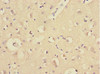 Immunohistochemistry of paraffin-embedded human brain tissue using CSB-PA774824ESR2HU at dilution of 1:100