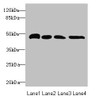 Western blot<br />
 All lanes: TXNDC5 antibody at 5.75µg/ml<br />
 Lane 1: HepG2 whole cell lysate<br />
 Lane 2: Colo320 whole cell lysate<br />
 Lane 3: Mouse brain tissue<br />
 Lane 4: Mouse stomach tissue<br />
 Secondary<br />
 Goat polyclonal to rabbit IgG at 1/10000 dilution<br />
 Predicted band size: 48, 37 kDa<br />
 Observed band size: 48 kDa<br />