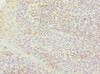 Immunohistochemistry of paraffin-embedded human tonsil tissue using CSB-PA868342ESR1HU at dilution of 1:100