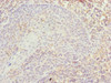 Immunohistochemistry of paraffin-embedded human tonsil tissue using CSB-PA868342ESR2HU at dilution of 1:100