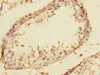 Immunohistochemistry of paraffin-embedded human testis tissue using CSB-PA837850ESR1HU at dilution of 1:100