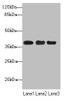 Western blot<br />
 All lanes: UBE2Z antibody at 1.68µg/ml<br />
 Lane 1: MCF-7 whole cell lysate<br />
 Lane 2: HepG2 whole cell lysate<br />
 Lane 3: Hela whole cell lysate<br />
 Secondary<br />
 Goat polyclonal to rabbit IgG at 1/10000 dilution<br />
 Predicted band size: 39, 29 kDa<br />
 Observed band size: 39 kDa<br />