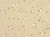 Immunohistochemistry of paraffin-embedded human brain tissue using CSB-PA875692ESR2HU at dilution of 1:100