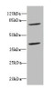 Western blot<br />
 All lanes: CBFA2T2antibody at 2.45µg/ml + Raji whole cell lysate<br />
 Secondary<br />
 Goat polyclonal to rabbit IgG at 1/10000 dilution<br />
 Predicted band size: 68, 64, 29, 66 kDa<br />
 Observed band size: 68, 40 kDa<br />