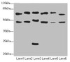 Western blot<br />
 All lanes: CSRNP2antibody at 2.34µg/ml<br />
 Lane 1: Mouse liver tissue<br />
 Lane 2: Mouse heart tissue<br />
 Lane 3: Mouse lung tissue<br />
 Lane 4: Mouse kidney tissue<br />
 Lane 5: HepG2 whole cell lysate<br />
 Lane 6: Mouse brain tissue<br />
 Secondary<br />
 Goat polyclonal to rabbit IgG at 1/10000 dilution<br />
 Predicted band size: 60 kDa<br />
 Observed band size: 60, 48, 24 kDa<br />