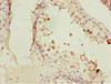 Immunohistochemistry of paraffin-embedded human testis tissue using CSB-PA008830ESR1HU at dilution of 1:100