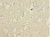 Immunohistochemistry of paraffin-embedded human brain tissue using CSB-PA008830ESR1HU at dilution of 1:100