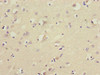 Immunohistochemistry of paraffin-embedded human brain tissue using CSB-PA008830ESR2HU at dilution of 1:100