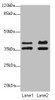 Western blot<br />
 All lanes: IKBIPantibody at 2.23µg/ml<br />
 Lane 1: Mouse kidney tissue<br />
 Lane 2: HL60 whole cell lysate<br />
 Secondary<br />
 Goat polyclonal to rabbit IgG at 1/10000 dilution<br />
 Predicted band size: 40, 28, 8, 44 kDa<br />
 Observed band size: 40, 36 kDa<br />
